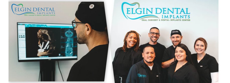 Elgin Dental Implants Cover Image
