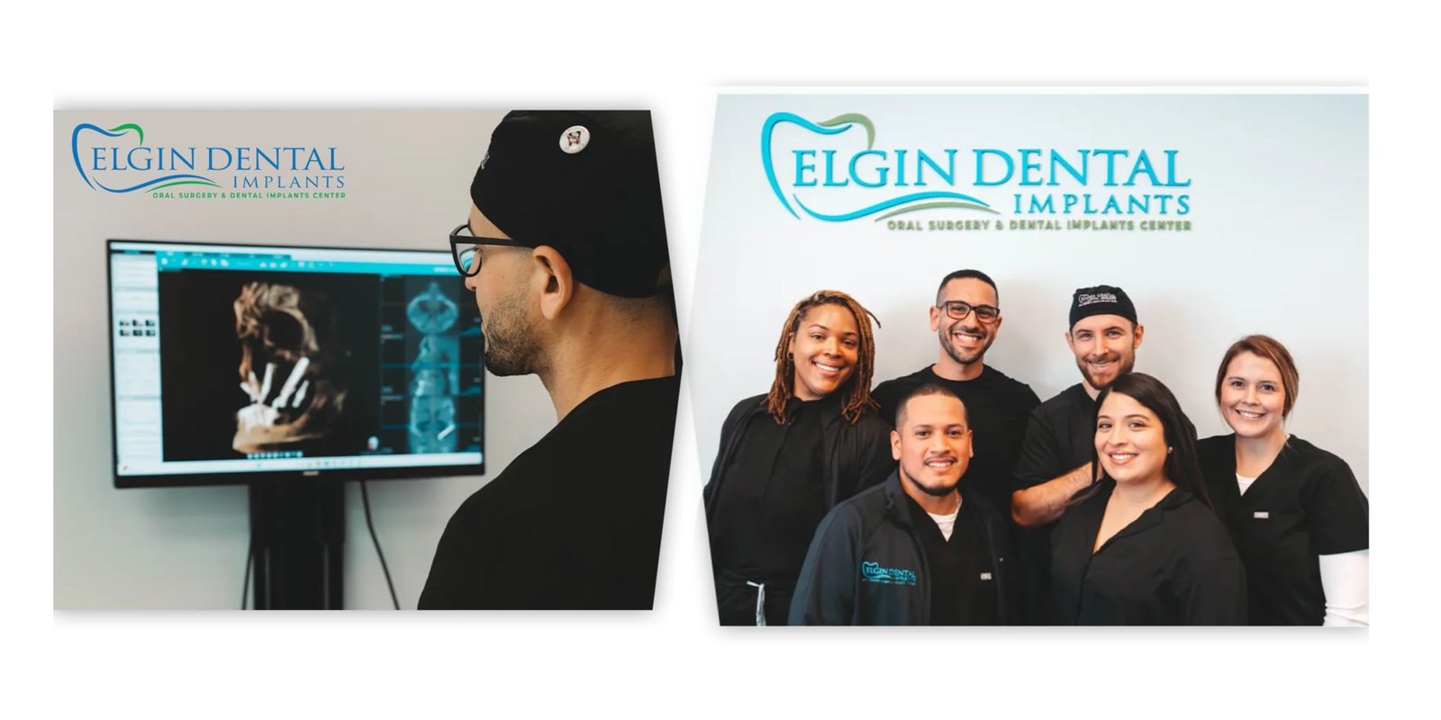 Whizolosophy | Nervous About Dental Implant Surgery? How Sedation Dentistry Is Making Treatment More Comfortable